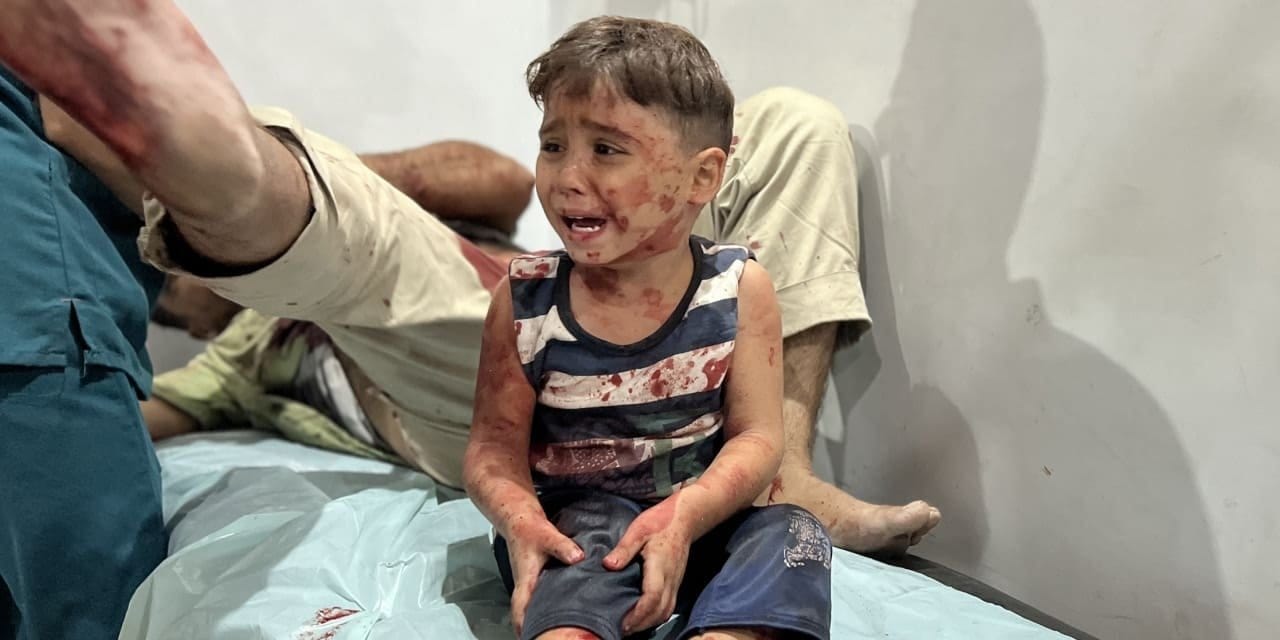 israilin abluka uyguladigi gazze seridinde acliktan olenlerin sayisi artiyor dRabn7uf